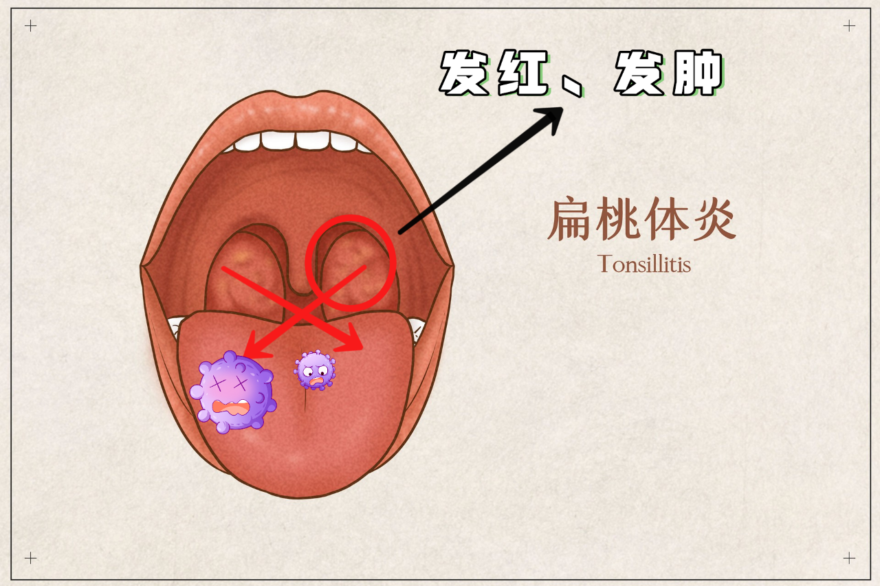 白喉措施_问题_健康宣教_百科名医网