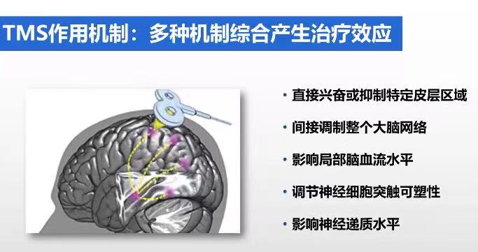 治疗揭秘丨让自闭症孩子干预更有效、缩短康复周期的新技术——重复经颅磁